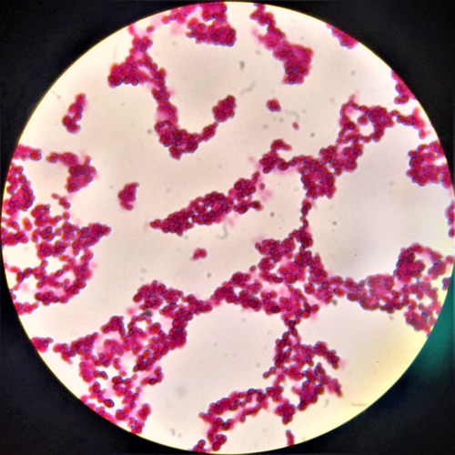 FUNGI Flashcards Quizlet