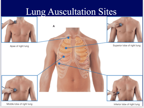 Lung Auscultation Review Flashcards | Quizlet