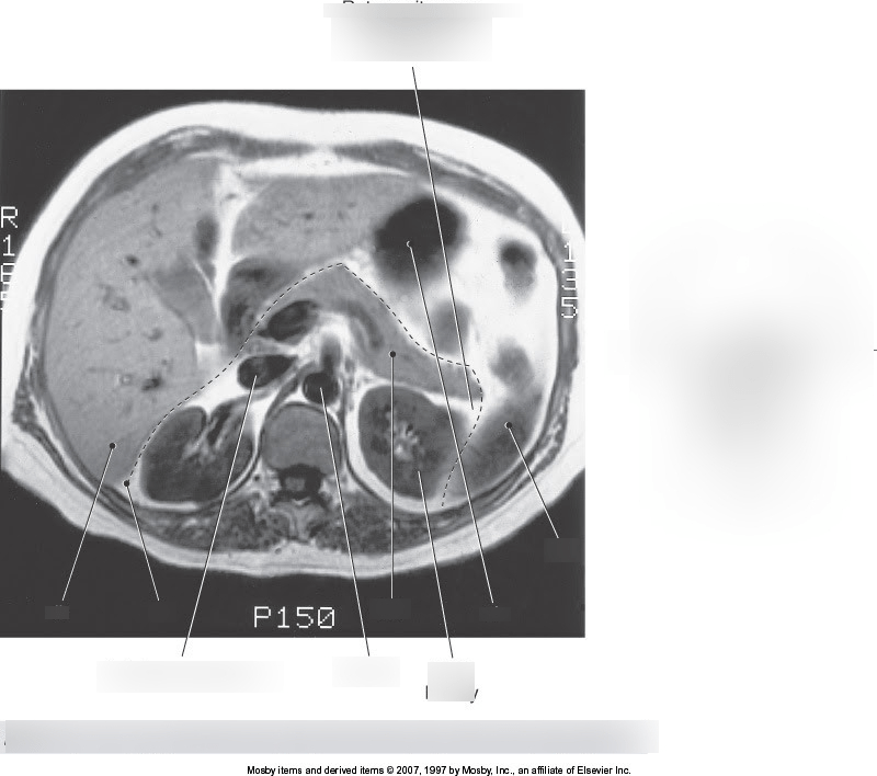 CSA 3 Diagram | Quizlet