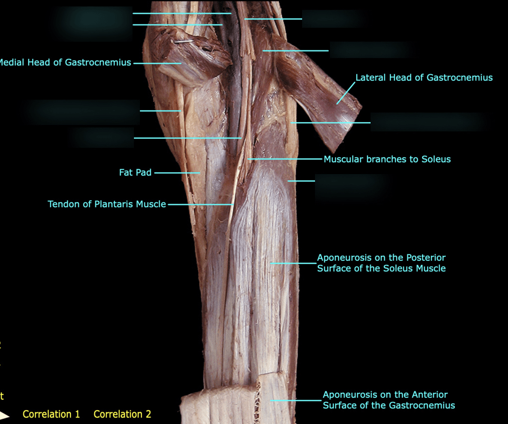 soleus and plantaris muscles Diagram Quizlet