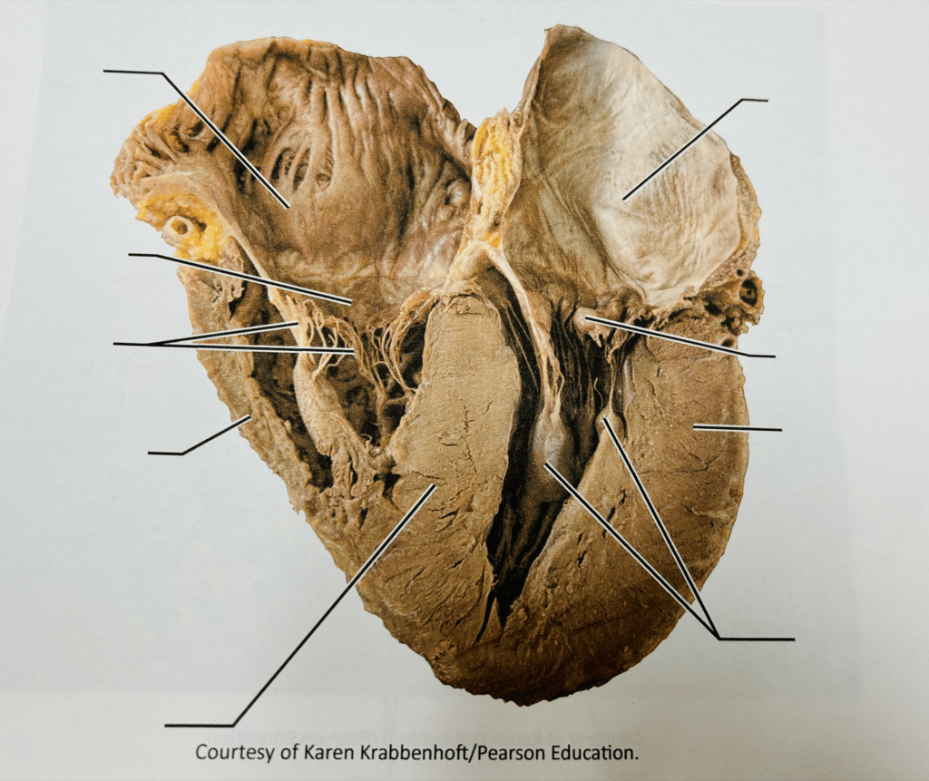 photograph of heart valves Diagram | Quizlet