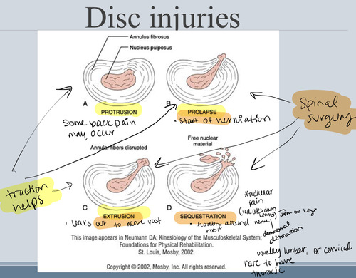 Traction Flashcards | Quizlet