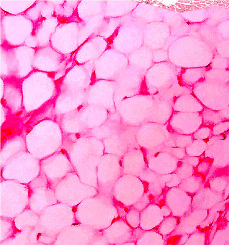 Connective Tissue Quiz Flashcards | Quizlet