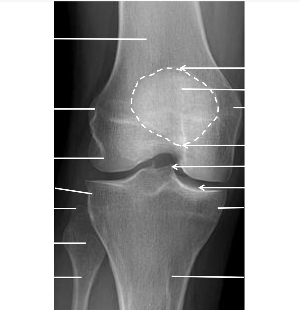 AP Knee XRay Labeled Diagram Quizlet