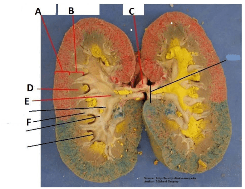 LAB 12 Pig/ Sheep Dissection Sheep Kidney Diagram Quizlet