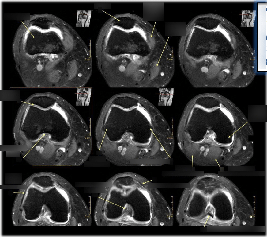Musculoskeletal Anatomy 21 Diagram Quizlet