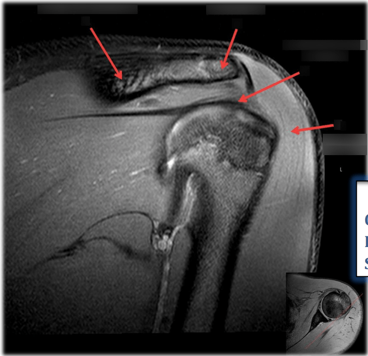 Musculoskeletal Anatomy 6 Diagram Quizlet