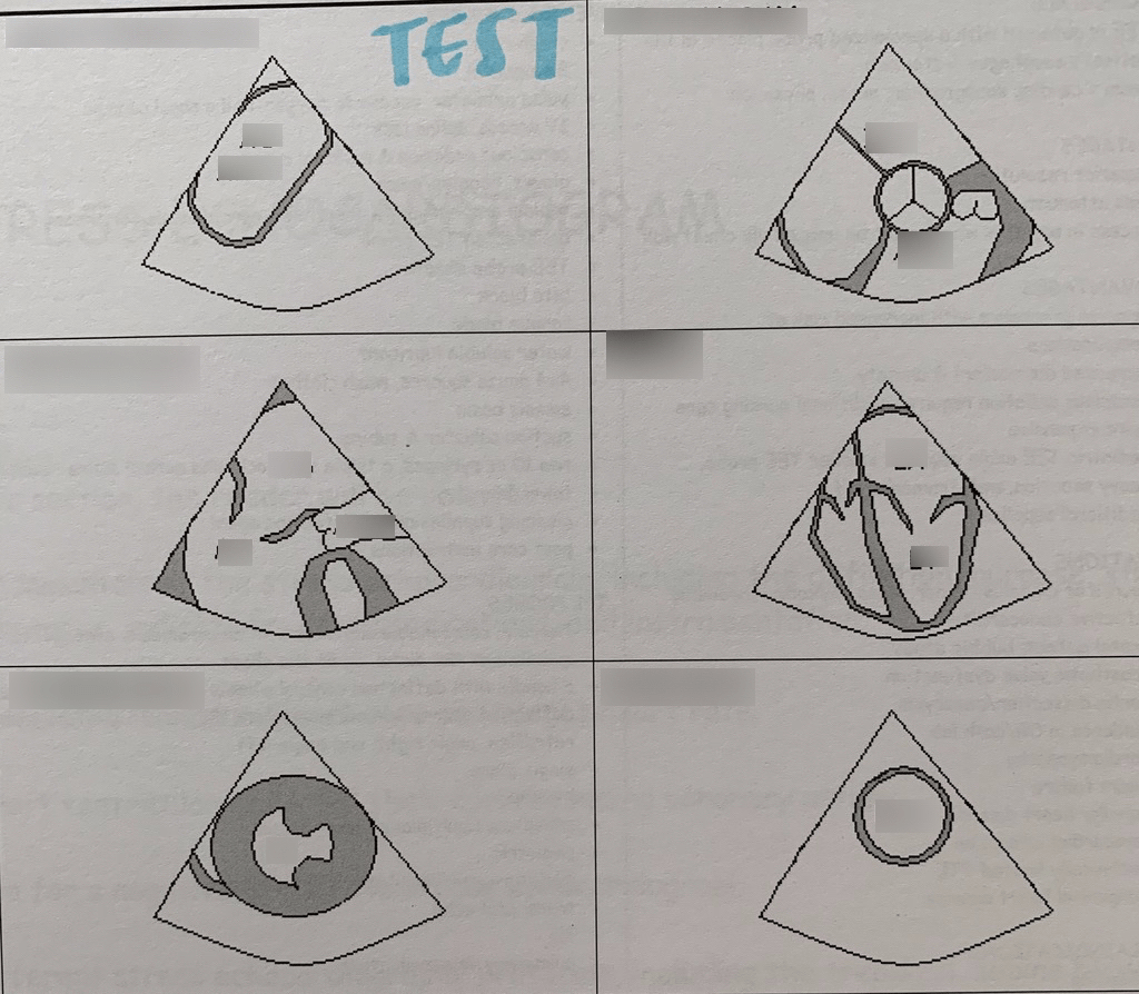 Echo TEE Diagram Quizlet