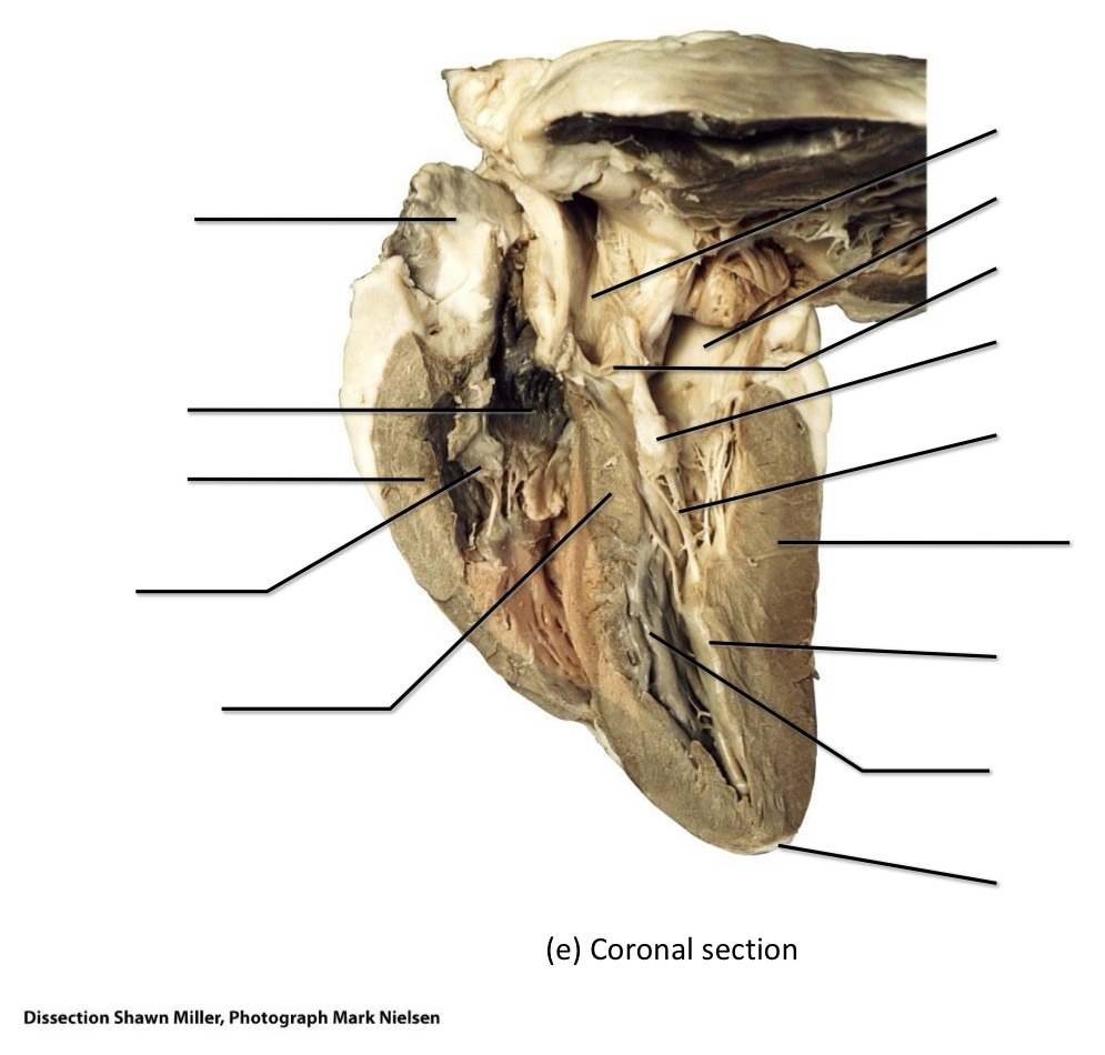 Sheep heart diagram Diagram | Quizlet