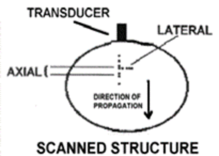 Transducer Resolution Diagram Quizlet