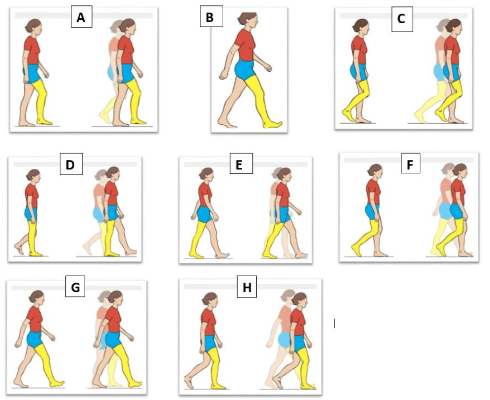 Normal Gait Cycle Diagram Quizlet