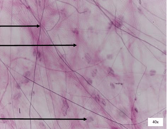 Areolar Connective Tissue Diagram | Quizlet