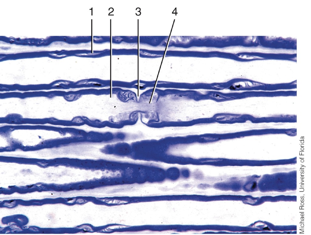 teased myelinated axon diagram Diagram | Quizlet
