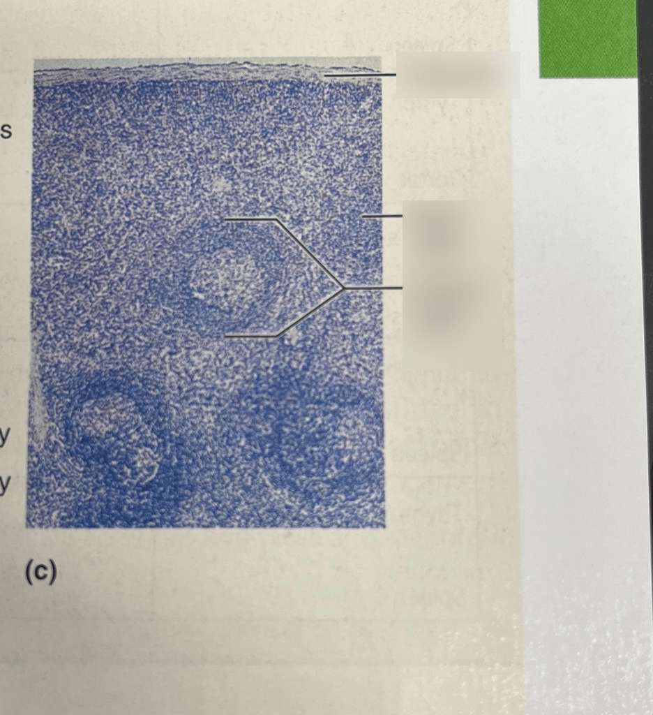Microscopic view of the spleen tissuelymphatic Diagram Quizlet