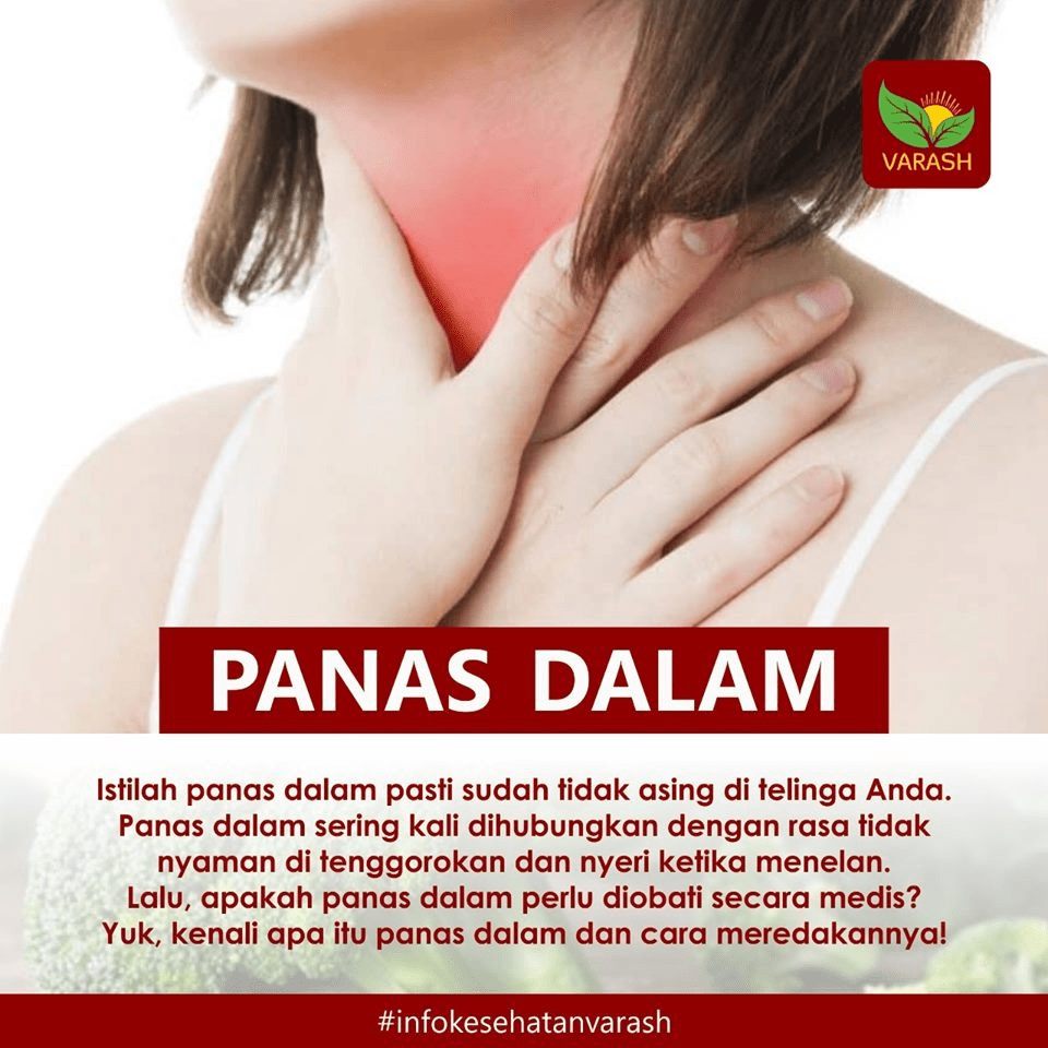Cara Mengobati Panas Dalam Varash