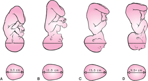 Normal Labor, Delivery, Newborn Care, and Puerperium Obgyn Key