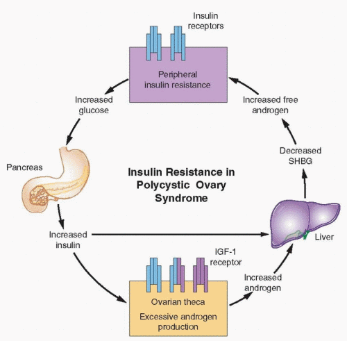 Chronic Anovulation and the Polycystic Ovary Syndrome Obgyn Key