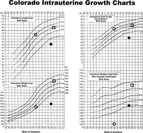 Weight For Gestational Age Chart