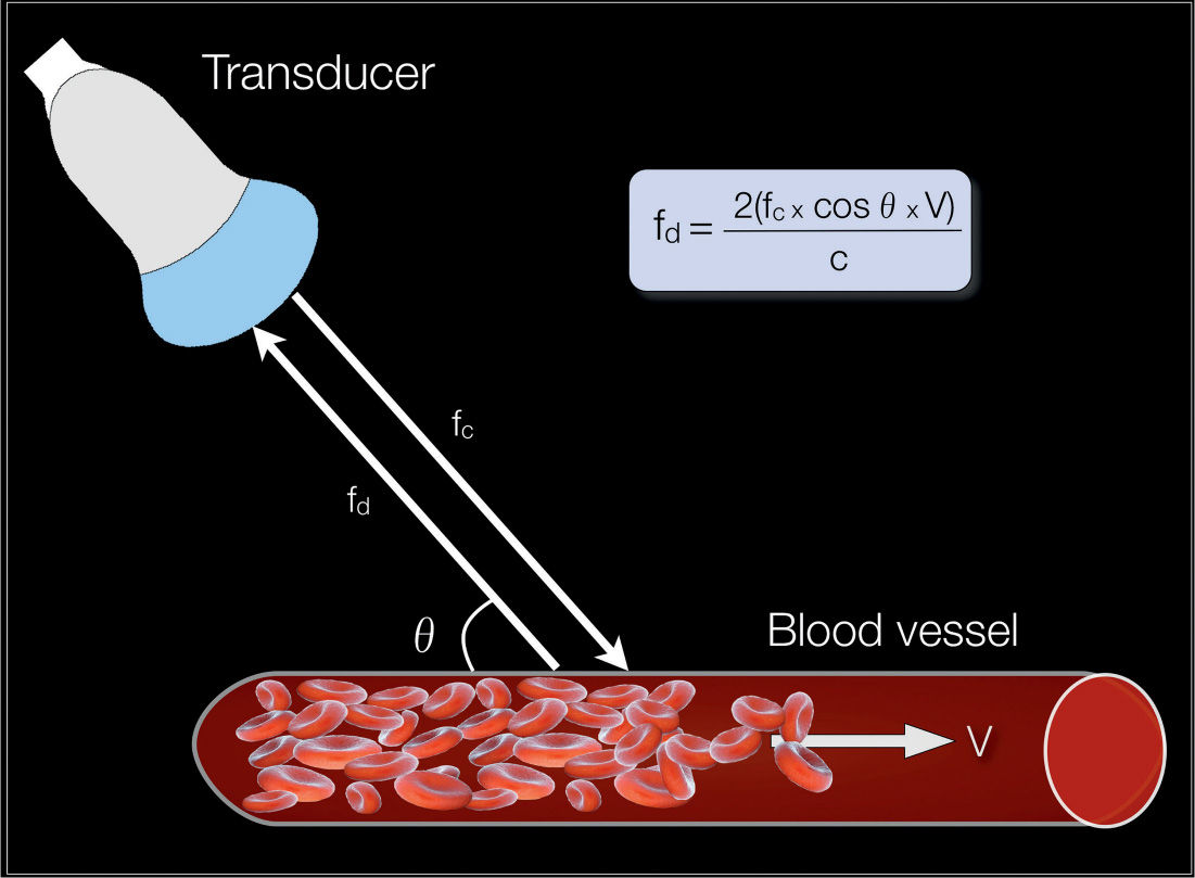 Pulsed Doppler in Fetal Echocardiography Obgyn Key