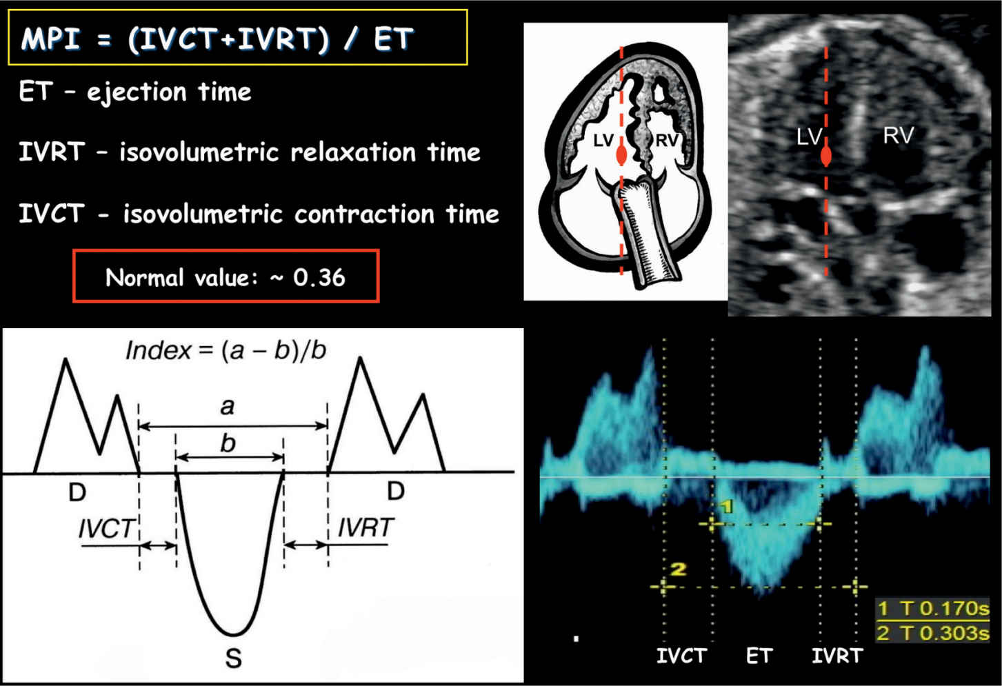 Fetal Cardiac Function Obgyn Key