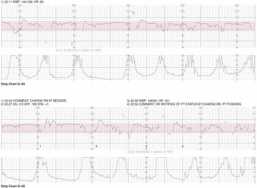 Exercises in Electronic Fetal Monitoring Obgyn Key
