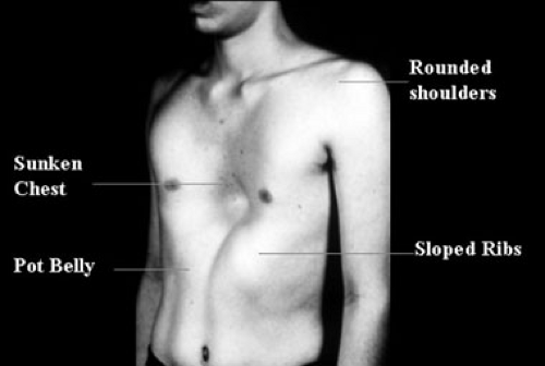 The Chest Wall Obgyn Key The Chest Wall Obgyn Key