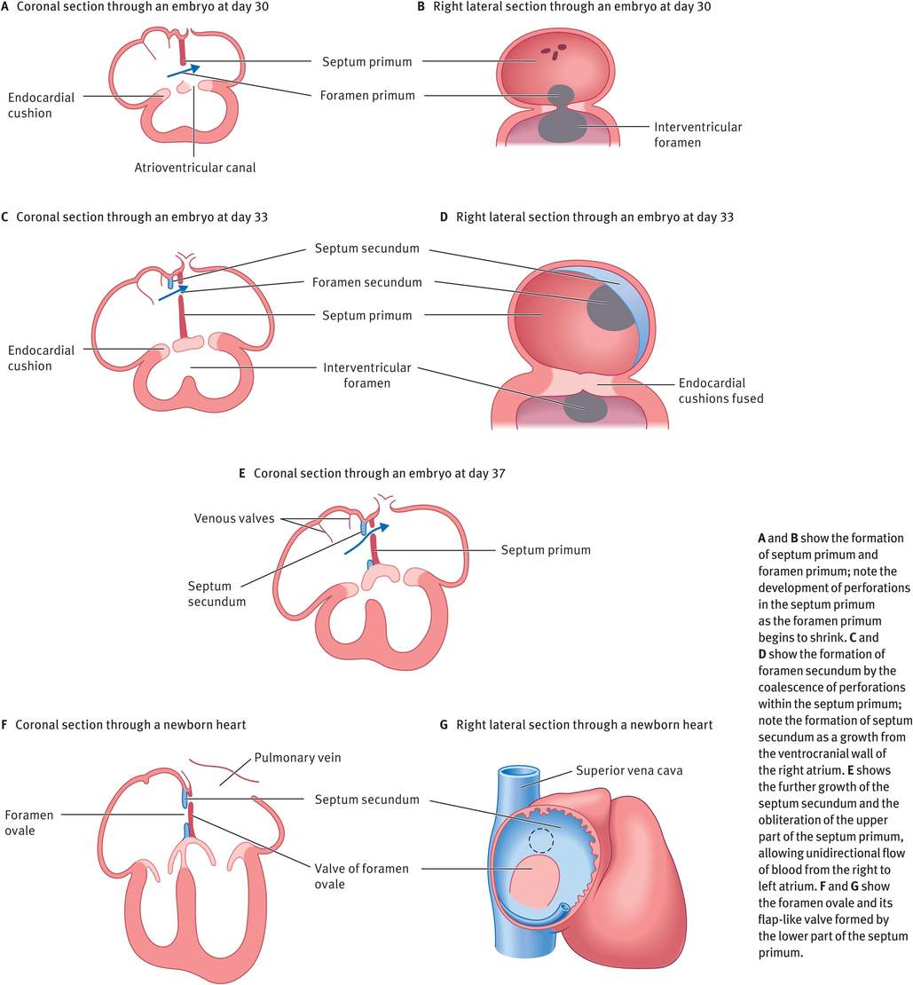 Development of the heart and the fetal circulation Obgyn Key