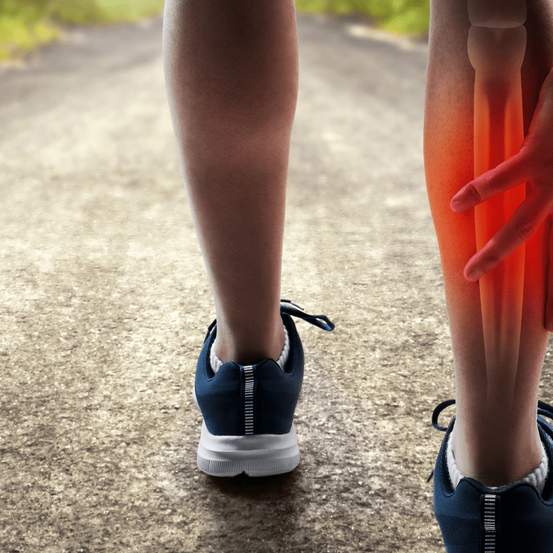 Lower Leg And Foot Pain In Runners OCR Buddy