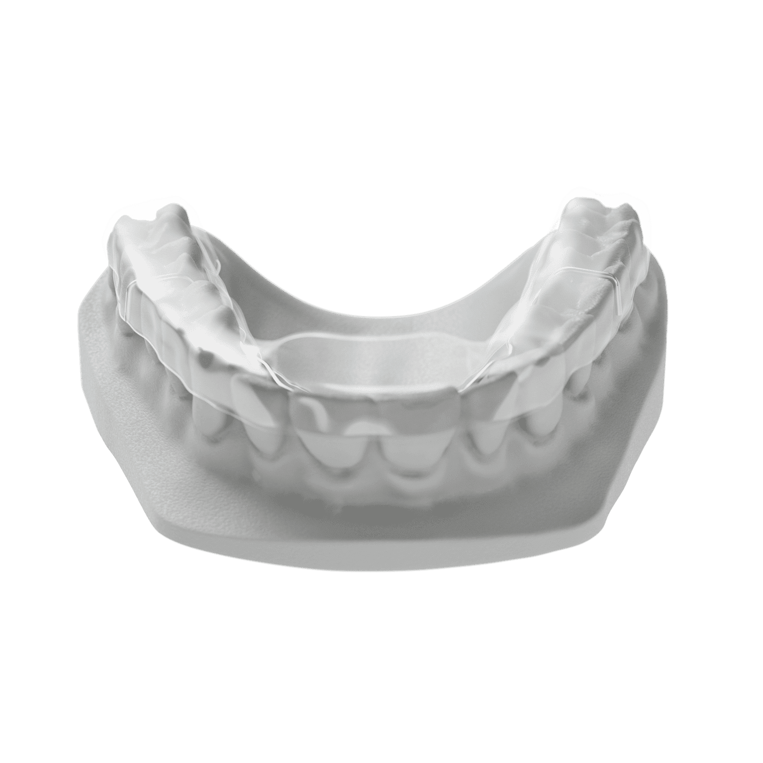 Digital Anterior Repositioning Splint ODL Orthodontic Labs