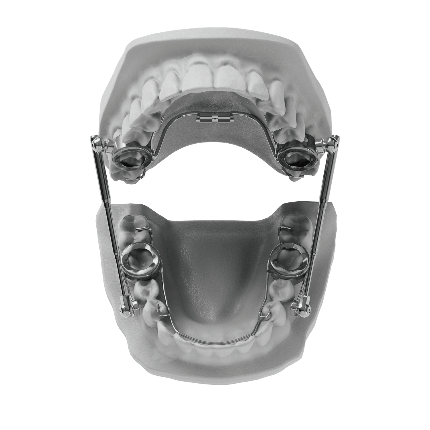 Miniscope Herbst ODL Orthodontic Labs