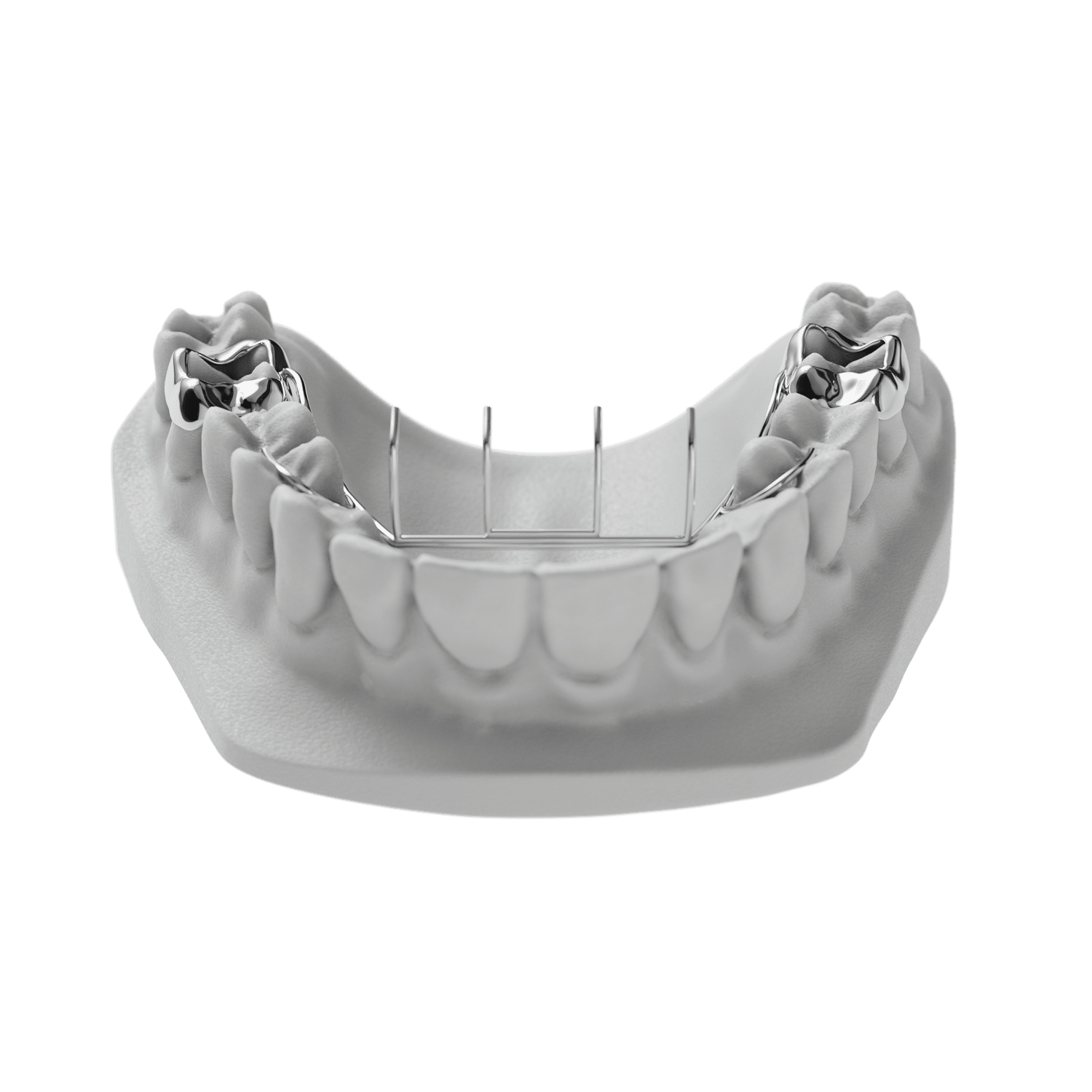 Rake Appliance ODL Orthodontic Labs