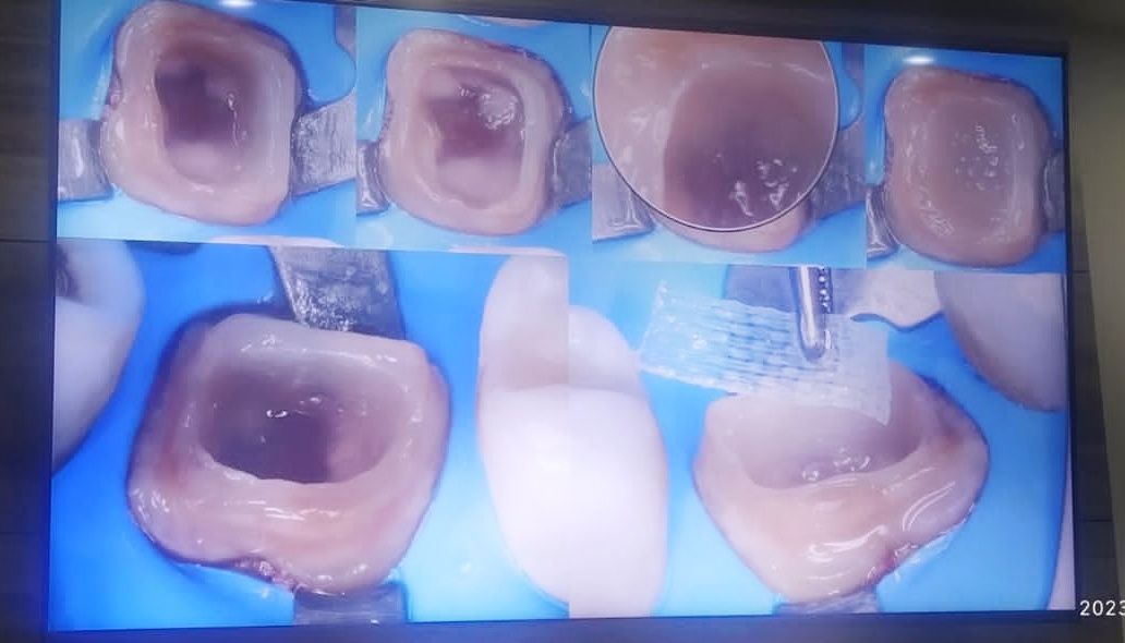 Odontología Biomimética 18 Beneficios Od. Luis Marcano