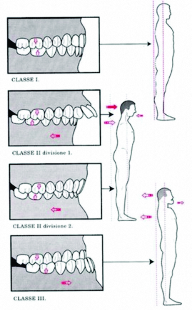 Odontodiva Atleta ATM, DTM, posição de repouso mandibular e postura