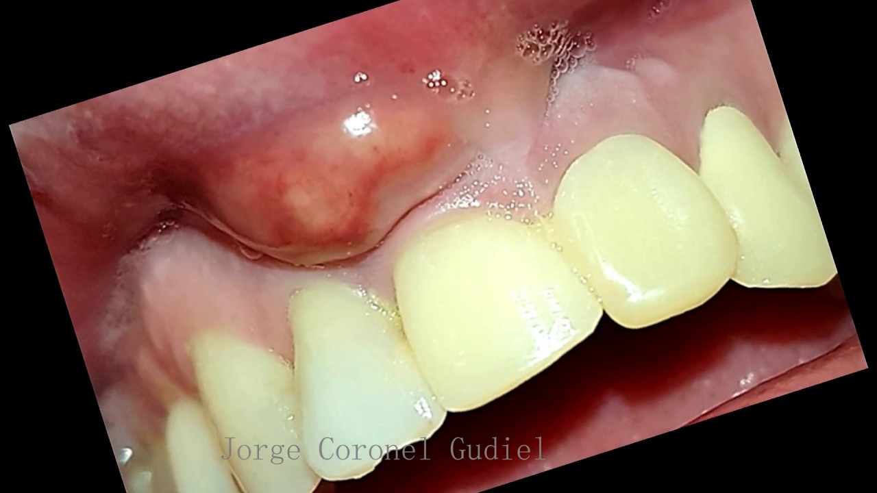 Periodoncia Odontología Odontopraxis