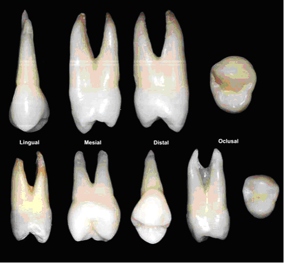 PréMolares Descrição Anatômica Odonto Up