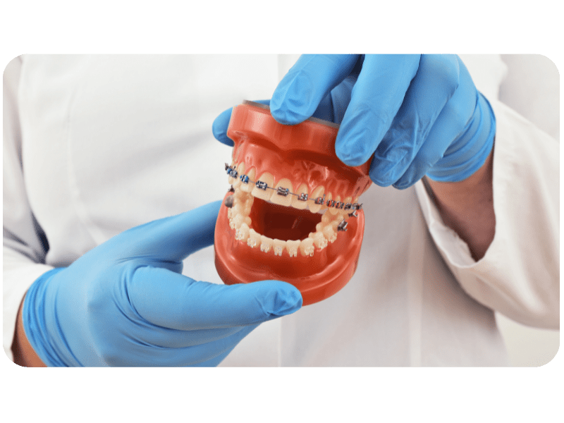 Braces & Implants ODS Dental Surgery