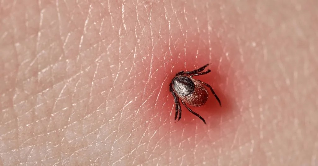 Symptoms Of Lyme Disease From A Tick Bite