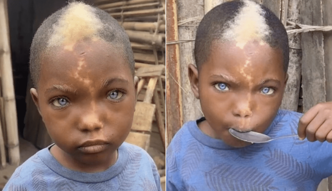 Black boy with natural blue eyes, white hairs and lightning mark down