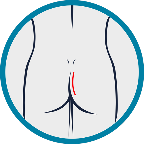 Epilation homme Montpellier à la cire Ohmsens