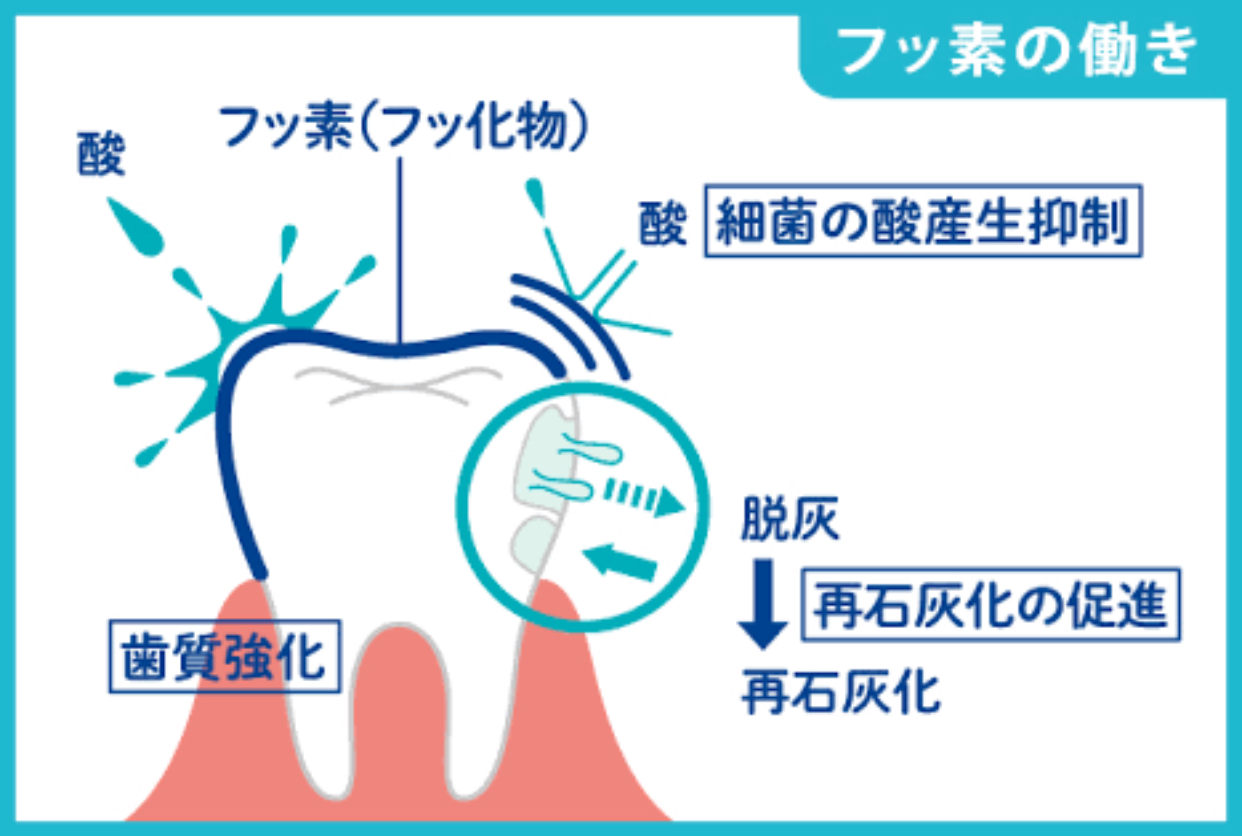 岡本の皆さんの虫歯を減らす『フッ素』の使い方