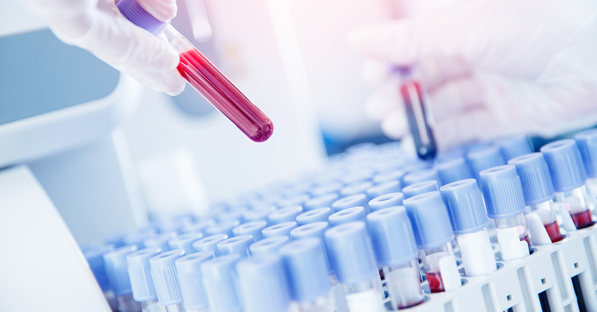 Weight Loss Lab Testing Oklahoma Men's Clinic