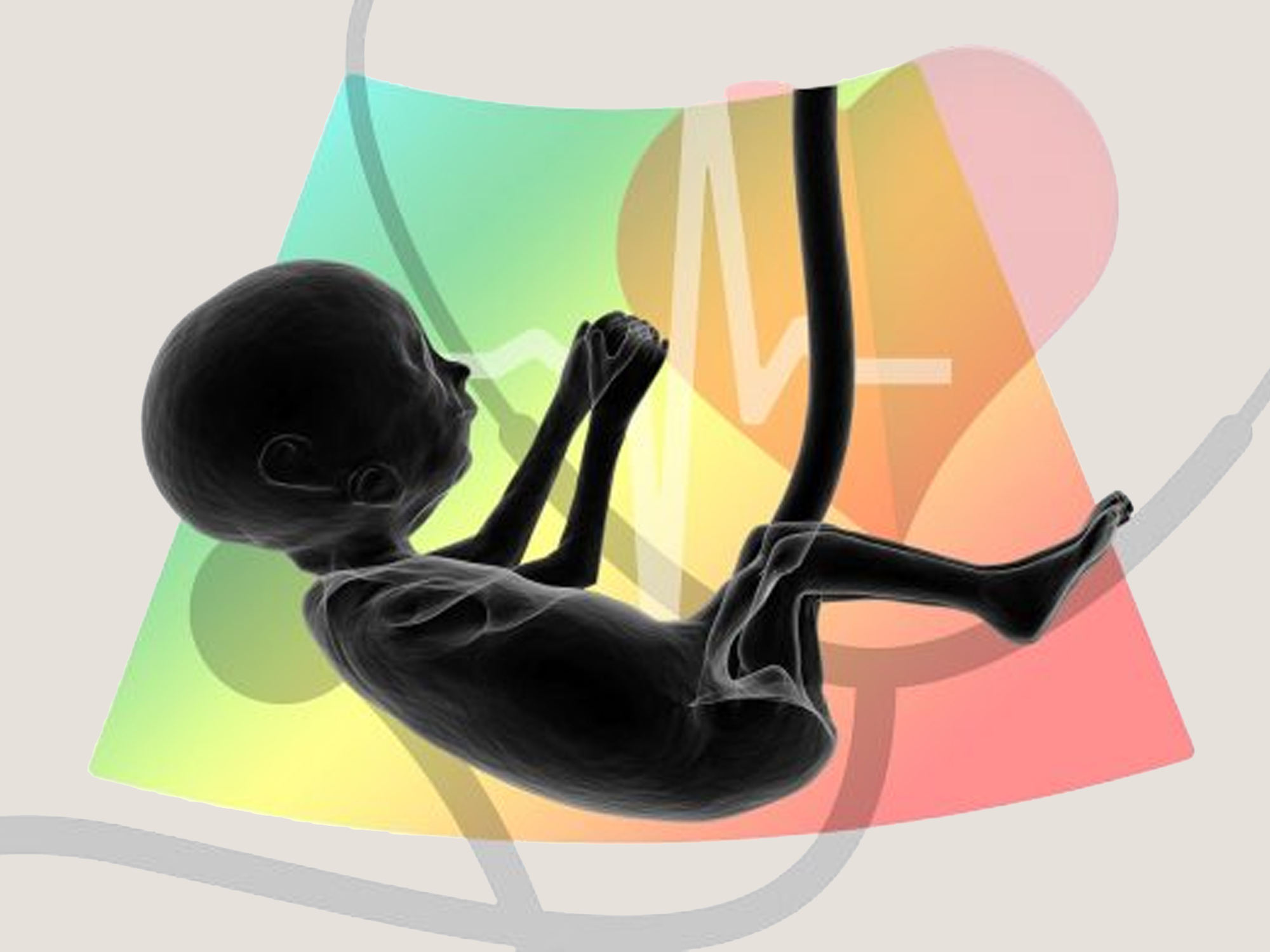 What Are the Effects of a Car Accident During Pregnancy? Hasbrook