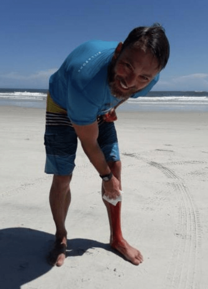 Surfista es mordido por tiburón tras caer encima Olas Perú, Reporte