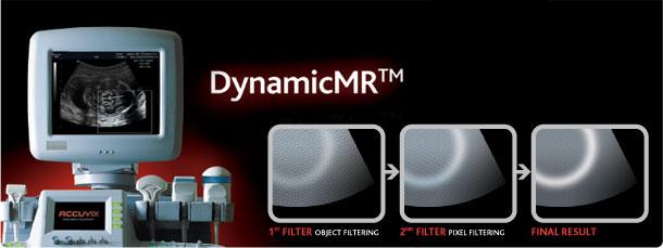 DynamicMR speckle reduktion filter
