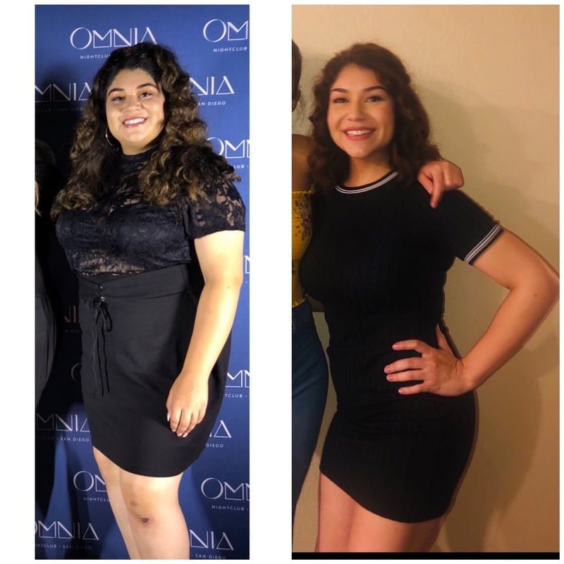 Weight Loss Surgery San Diego Olde Del Mar Surgical