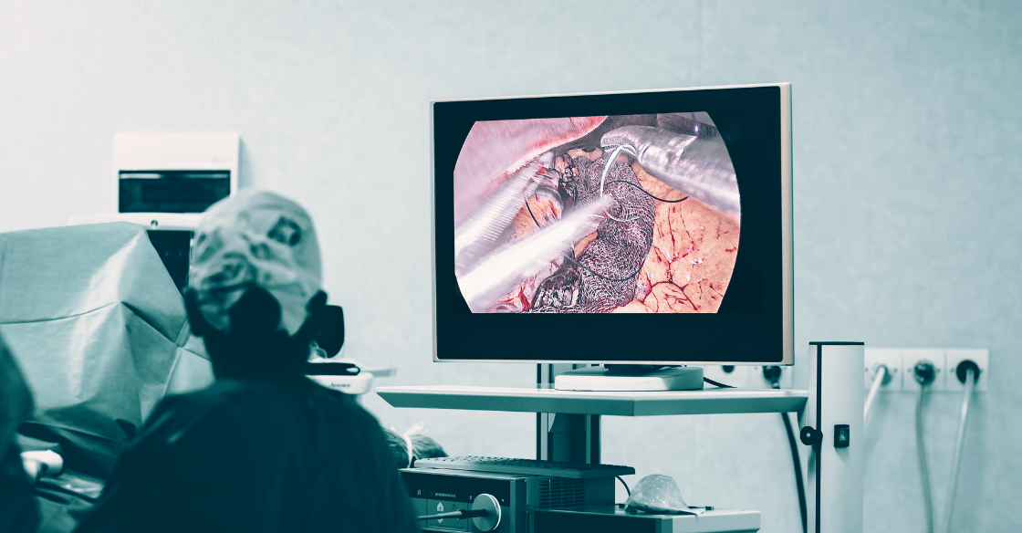 Lapband Vs. Gastric Sleeve Surgery Olde Del Mar Surgical