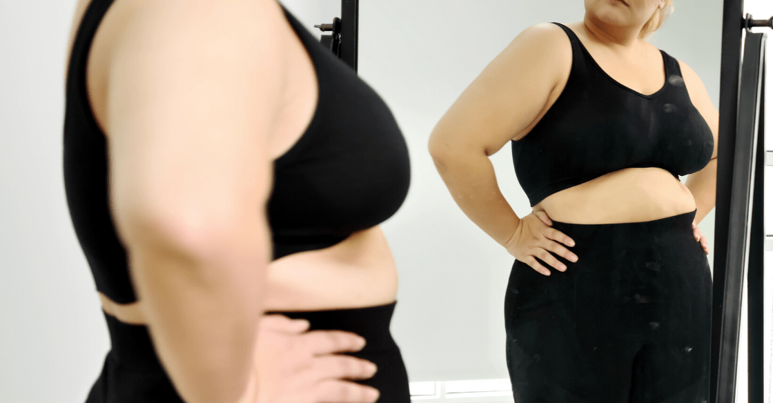 How to Manage Loose Skin After Weight Loss Surgery Olde Del Mar