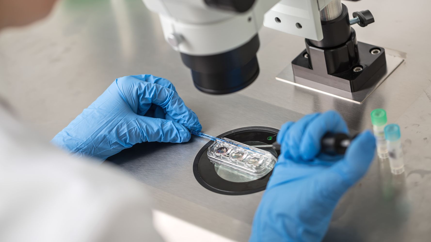 Frozen Embryo Transfer Omega Golden Fertility Clinic