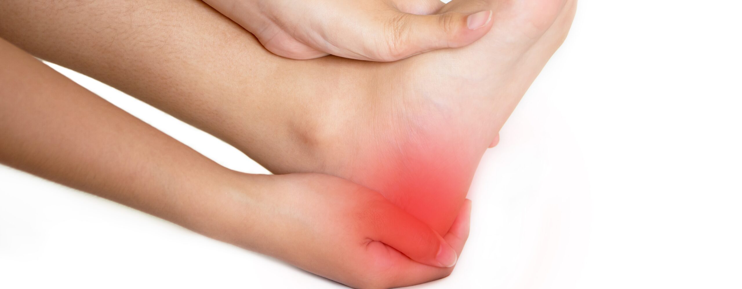 Heel Ulcers, Bed Sores, and the Never Event List Omeza