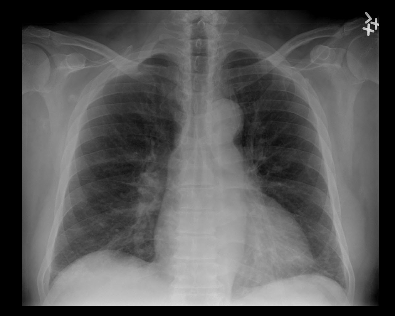 On Call Radiology common radiology findings on call and in the